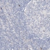 Anti-DNAH5 antibody produced in rabbit Prestige Antibodies® Powered by Atlas Antibodies, affinity isolated antibody, buffered aqueous glycerol solution