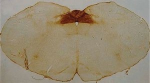 Anti-Polysialic Acid-NCAM Antibody, clone 2-2B ascites fluid, clone 2-2B, Chemicon®