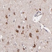 Anti-NF2 antibody produced in rabbit Prestige Antibodies® Powered by Atlas Antibodies, affinity isolated antibody, buffered aqueous glycerol solution