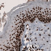Monoclonal Anti-PARP1 Prestige Antibodies® Powered by Atlas Antibodies, clone CL2209, purified immunoglobulin, buffered aqueous glycerol solution