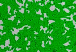 OSUMMER.9 Mouse NRAS-Mutant Melanoma Cell Line