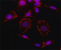 Anti-Caveolin-1 antibody produced in rabbit IgG fraction of antiserum, buffered aqueous solution