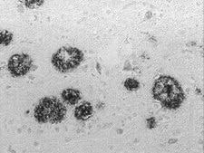 Anti-Amyloid Antibody, β 1-16, clone DE2 culture supernatant, clone DE2, Chemicon®