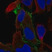 Anti-FYN antibody produced in rabbit Prestige Antibodies® Powered by Atlas Antibodies, affinity isolated antibody, buffered aqueous glycerol solution