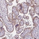 Anti-EPN3 antibody produced in rabbit Prestige Antibodies® Powered by Atlas Antibodies, affinity isolated antibody, buffered aqueous glycerol solution