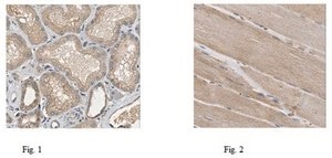 Anti-NOX4 Antibody from rabbit