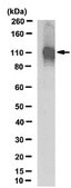 Anti-NMDAR1 Antibody, clone 1.17.2.6, rabbit monoclonal clone 1.17.2.6, from rabbit, unconjugated