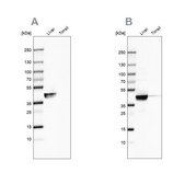 抗ACAT1抗体 ウサギ宿主抗体 Ab1, Prestige Antibodies® Powered by Atlas Antibodies, affinity isolated antibody, buffered aqueous glycerol solution