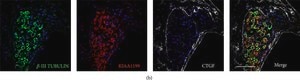 Monoclonal Anti-β-Tubulin III antibody produced in mouse clone SDL.3D10, ascites fluid