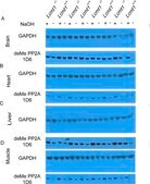 Anti-PP2A Antibody, C subunit, clone 1D6 clone 1D6, Upstate®, from mouse