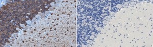 Anti-MAP2 Antibody, clone 5F9 clone 5F9, Upstate®, from mouse