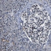 Anti-POSTN antibody produced in rabbit Prestige Antibodies® Powered by Atlas Antibodies, affinity isolated antibody, buffered aqueous glycerol solution