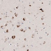 Anti-GGH antibody produced in rabbit Prestige Antibodies® Powered by Atlas Antibodies, affinity isolated antibody, buffered aqueous glycerol solution