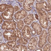 Anti-CLPX antibody produced in rabbit Prestige Antibodies® Powered by Atlas Antibodies, affinity isolated antibody, buffered aqueous glycerol solution