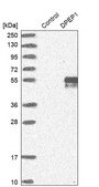 Anti-DPEP1 antibody produced in rabbit Prestige Antibodies® Powered by Atlas Antibodies, affinity isolated antibody, buffered aqueous glycerol solution
