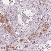 Anti-WWOX antibody produced in rabbit Prestige Antibodies® Powered by Atlas Antibodies, affinity isolated antibody, buffered aqueous glycerol solution