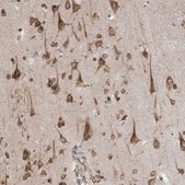 Anti-WWP1 antibody produced in rabbit Prestige Antibodies® Powered by Atlas Antibodies, affinity isolated antibody, buffered aqueous glycerol solution