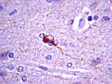 Anti-Somatostatin Antibody, clone YC7 culture supernatant, clone YC7, Chemicon®