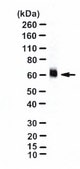 Anti-Glutamate Transporter Antibody, Glial serum, Chemicon®