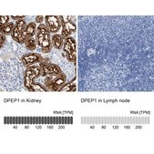 Anti-DPEP1 antibody produced in rabbit Prestige Antibodies® Powered by Atlas Antibodies, affinity isolated antibody, buffered aqueous glycerol solution
