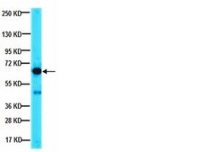 Anti-PP2A Antibody, Catalytic subunit Upstate®, from rabbit