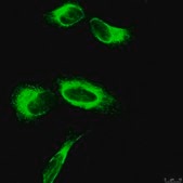 Anti-APP A4 Antibody, a.a. 66-81 of APP {NT}, clone 22C11 clone 22C11, Chemicon®, from mouse