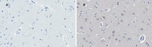 Anti-Huntingtin Protein Antibody, clone 1M11, ZooMAb® Rabbit Monoclonal recombinant, expressed in HEK 293 cells