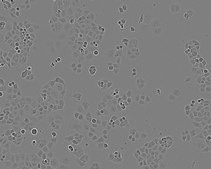 PANC-1 Cell Line human NOTE: Both the cell line and DNA from the cell line may be available for this product. Please choose -1VL or VIAL for cells, or -DNA-5UG for DNA, 87092802, human pancreas, Epithelial