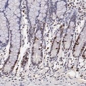 抗MKI67抗体 ウサギ宿主抗体 Ab1, Prestige Antibodies® Powered by Atlas Antibodies, affinity isolated antibody, buffered aqueous glycerol solution