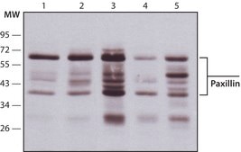 モノクロナール抗パキシリン マウス宿主抗体 clone PXC-10, ascites fluid