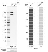 抗MYOF ウサギ宿主抗体 Prestige Antibodies® Powered by Atlas Antibodies, affinity isolated antibody, buffered aqueous glycerol solution