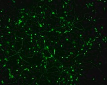 Human Cortical GABAergic Neurons Human iPSC line, Fully differentiated, Healthy Male Control (no known neurological disorders), Cryopreserved