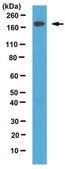 Anti-Telo-Collagen Type I, A1/COL1A1 from rabbit, purified by affinity chromatography