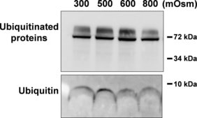 Anti-Ubiquitin Antibody, clone P4D1-A11 clone P4D1-A11, Upstate®, from mouse