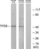 Anti-TFEB antibody produced in rabbit affinity isolated antibody
