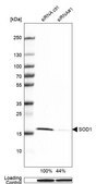 Anti-SOD1 antibody produced in rabbit Prestige Antibodies® Powered by Atlas Antibodies, affinity isolated antibody, buffered aqueous glycerol solution