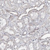 Anti-MAN1A2 antibody produced in rabbit Prestige Antibodies® Powered by Atlas Antibodies, affinity isolated antibody, buffered aqueous glycerol solution