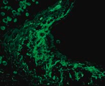 Anti-Tenascin Antibody Chemicon®, from rabbit