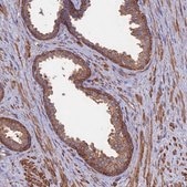 Anti-DNM1L antibody produced in rabbit Prestige Antibodies® Powered by Atlas Antibodies, affinity isolated antibody, buffered aqueous glycerol solution