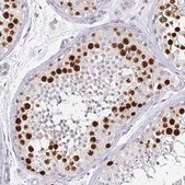 抗ANLN抗体 マウス宿主抗体 Prestige Antibodies® Powered by Atlas Antibodies, clone CL0301, purified immunoglobulin, buffered aqueous glycerol solution