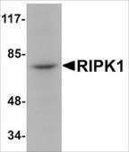 Anti-RIPK1 antibody produced in rabbit affinity isolated antibody, buffered aqueous solution