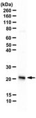 Anti-Recoverin Antibody from rabbit, purified by affinity chromatography
