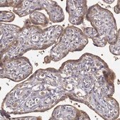 Anti-CRIM1 antibody produced in rabbit Prestige Antibodies® Powered by Atlas Antibodies, affinity isolated antibody, buffered aqueous glycerol solution