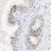 Anti-GDF15 antibody produced in rabbit Prestige Antibodies® Powered by Atlas Antibodies, affinity isolated antibody, buffered aqueous glycerol solution