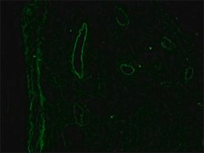 Monoclonal Anti-Desmin antibody produced in mouse clone DE-U-10, ascites fluid