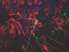 Anti-Beta III Tubulin Antibody Chemicon®, from chicken