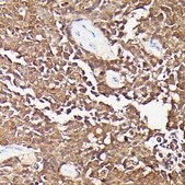 Anti-CDKN2A/p16INK4a antibody produced in mouse