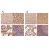 Anti-FSCN1 antibody produced in rabbit Prestige Antibodies® Powered by Atlas Antibodies, affinity isolated antibody, buffered aqueous glycerol solution