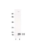 Anti-acetyl-Lysine Antibody serum, Upstate®