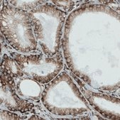 Monoclonal Anti-MTDH antibody produced in mouse Prestige Antibodies® Powered by Atlas Antibodies, clone CL0397, purified immunoglobulin, buffered aqueous glycerol solution